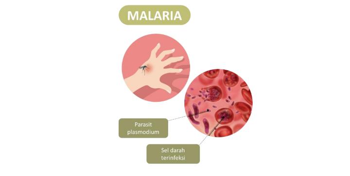 Malaria